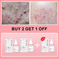 Collagen Peptide Facial Serum Targets Dull Skin Boosts Skin Elasticity Stimulates Skin Renewal Repair Salmon PDRN KOREAN Product